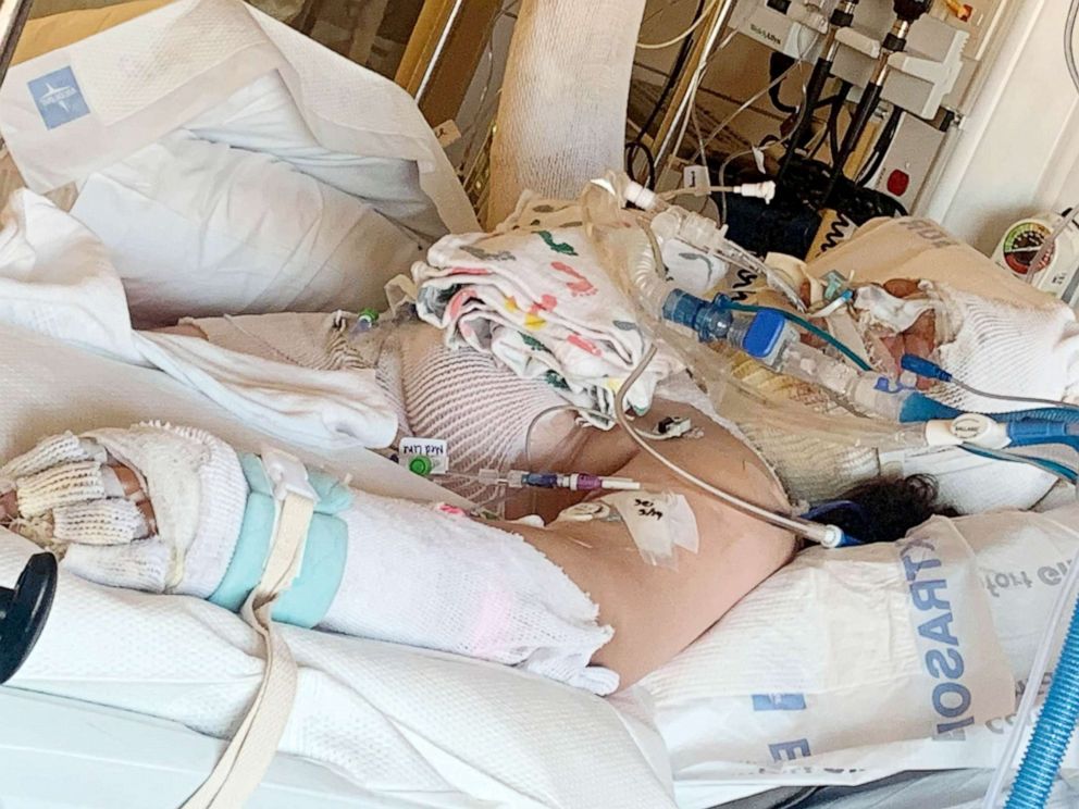 PHOTO: : Destini Crane, 13, was hospitalized with third-degree burns after apparently attempting to imitate a TikTok video, said her family, who now want to warn others about what happened to her.