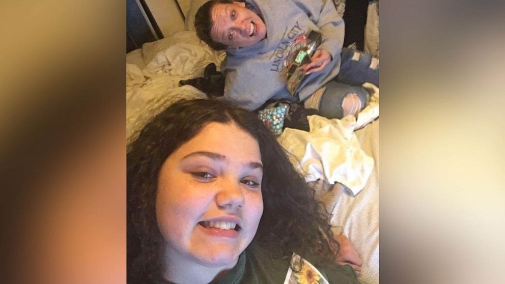 13-year-old girl severely burned while imitating TikTok video, family says