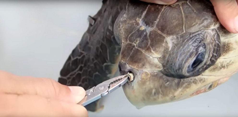 PHOTO: Unidentified mariners try to remove a drinking straw lodged in a sea turtle's nose in a video posted to YouTube by CostanRicanSeaTurtles, Aug. 10, 2015.