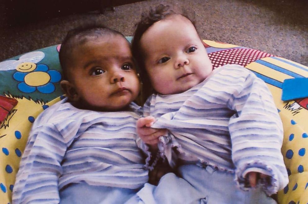 PHOTO: Millie, left, and Marcia, right as babies.