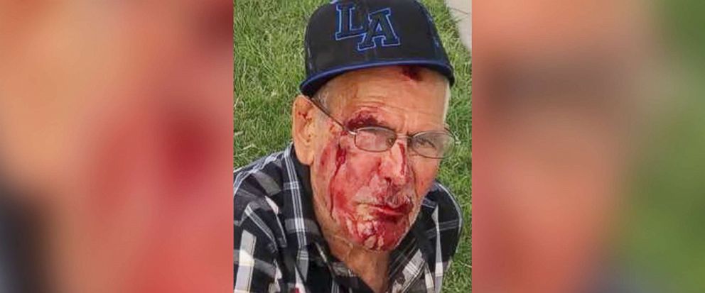 PHOTO: A 92-year-old man was struck with a brick and injured in Los Angeles, July 4, 2018.