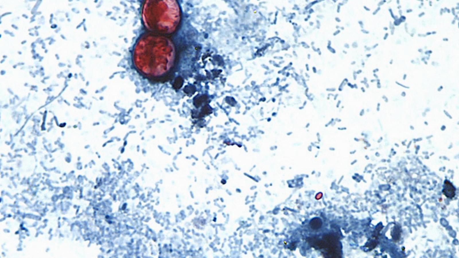 US officials tie cyclospora outbreak involving iceberg lettuce to 3 more states