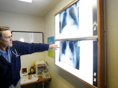 Court upholds finding that Montana clinic submitted false asbestos claims