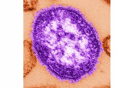 Inside the Measles Outbreak: The Fatal Cost of Public Health Blind Spots