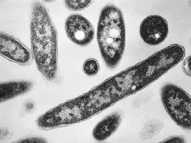 New cases slow in NYC Legionnaires' disease outbreak; Met museum among buildings with positive tests