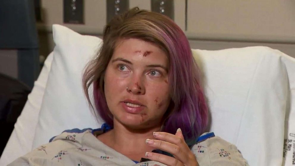 PHOTO: Brittany Fintel, 32, was hiking when she fell around 300 to 500 feet from the monitor ridge climbing route after losing her footing on snow and ice on Mount St. Helens.