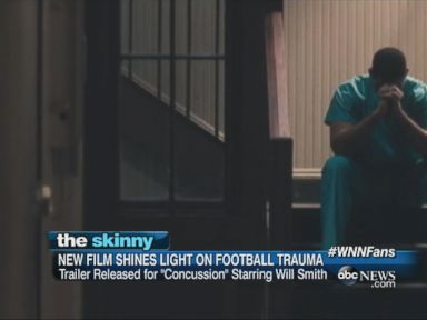 VIDEO: "Concussion" starring Will Smith tells the story of Bennet Omalu, the real-life doctor who diagnosed the first case of Chronic Traumatic Encephalopathy (a degenerative disease of the brain) in a former NFL player.