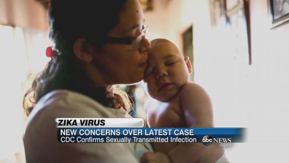 Video New Concerns Over The Latest Zika Virus Case Abc News 
