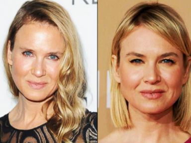 VIDEO: Instant Index: Renee Zellweger's New Look