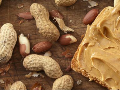 VIDEO: New Research Being Labeled a 'Breakthrough' on Peanut Allergies