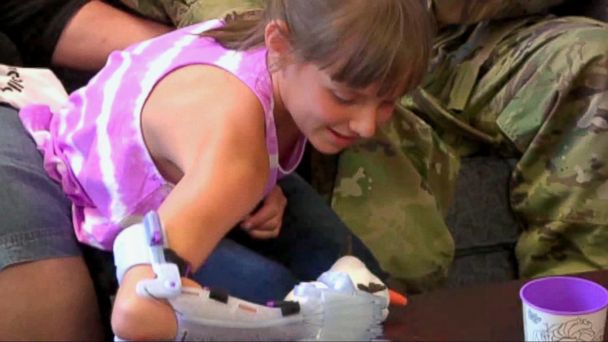 608px x 342px - Video Young Girl Receives a Special Gift - ABC News