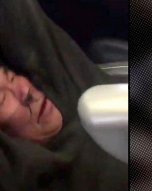 VIDEO: United passenger dragged off plane will need reconstructive surgery for his injuries, lawyer says