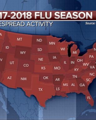 VIDEO: 'Widespread' flu activity reported in 46 states