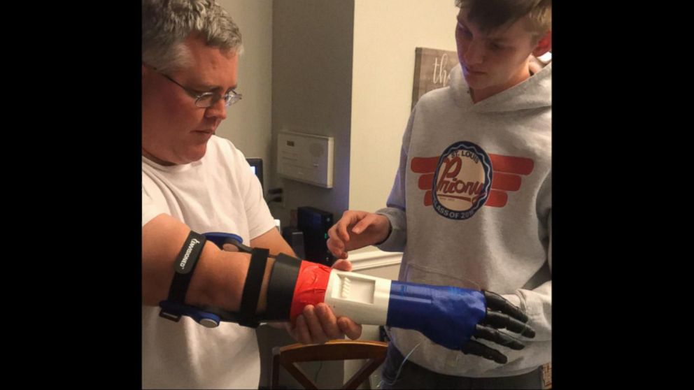 Teen Builds Baseball Throwing Prosthetic Arm For Father Injured During Iraq Tour Abc News,Residential Interior Design Contract Template