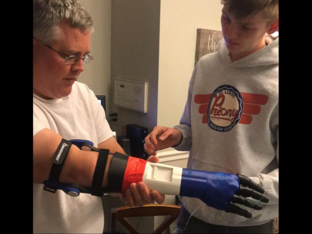 Teen builds baseball-throwing prosthetic arm for father injured during Iraq  tour - ABC News