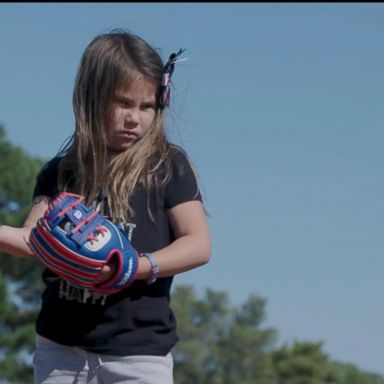 VIDEO: Girl with 3-D hand bringing awareness to rare disease with every throw