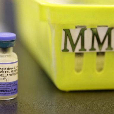 VIDEO: CDC tracking at least 465 measles cases in 19 states - a near record