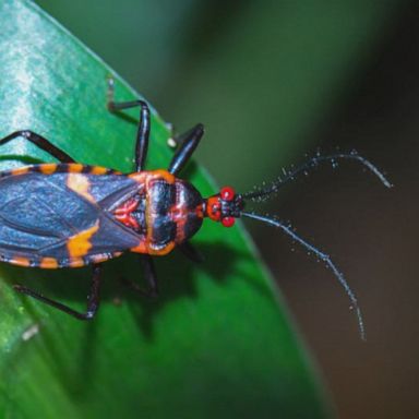 The Centers for Disease Control and Prevention (CDC) has confirmed a 2018 case in which a blood-sucking insect known as a "kissing bug" bit a child in the face.