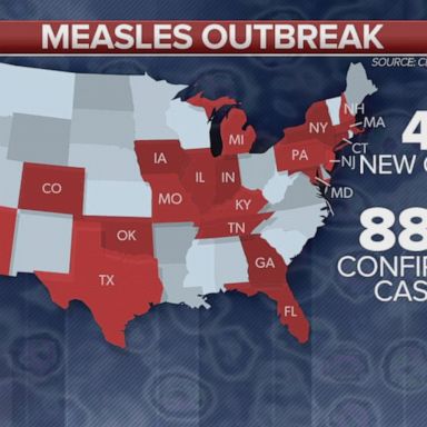 The 41 new cases from the previous week make it the largest number of measles cases in the U.S. in 25 years.