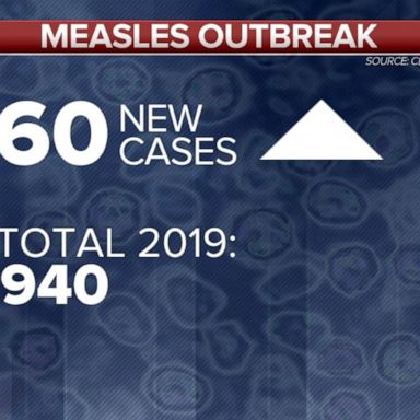 VIDEO: 60 new cases of measles reported, bringing current total to 940: CDC