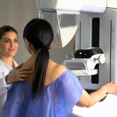 VIDEO: New guidelines to hopefully improve breast cancer screening