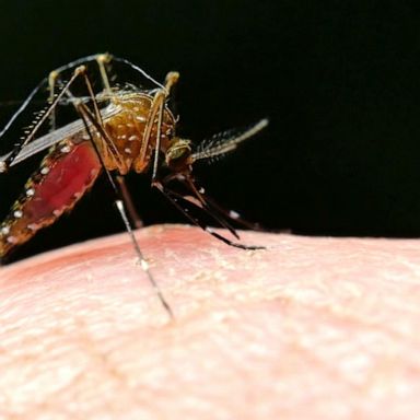 VIDEO: CDC confirms Indiana’s first rare mosquito-borne virus death