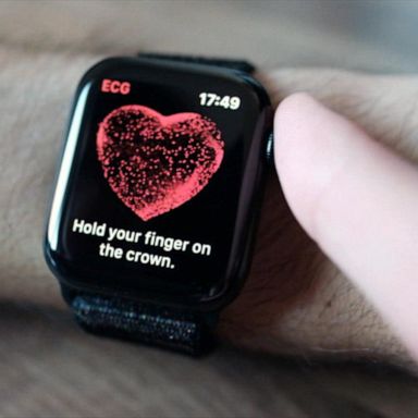 VIDEO: Apple Watch reliably detects atrial fibrillations: Study