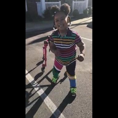 VIDEO: Mom inspires by documenting daughter with cerebral palsy learning to walk