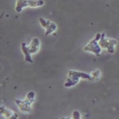 VIDEO: Brain-eating amoeba found in Texas water supply