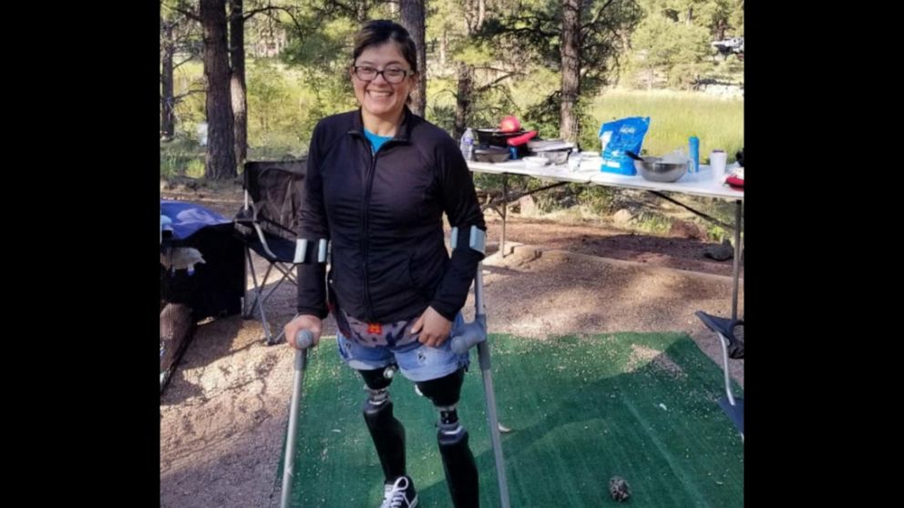 Hanger Clinic Blog | Norma Trujillo: Inspired by her Children, Mom of Three  Triumphs After Losing Both Legs While Acting as a Good Samaritan