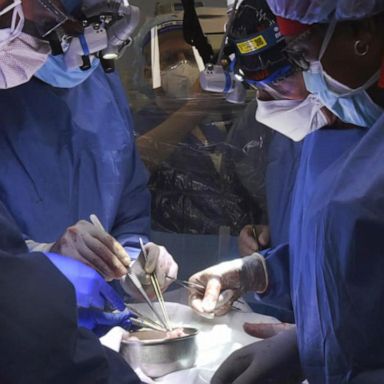 VIDEO: Doctors say they’ve transplanted a pig heart into a human patient