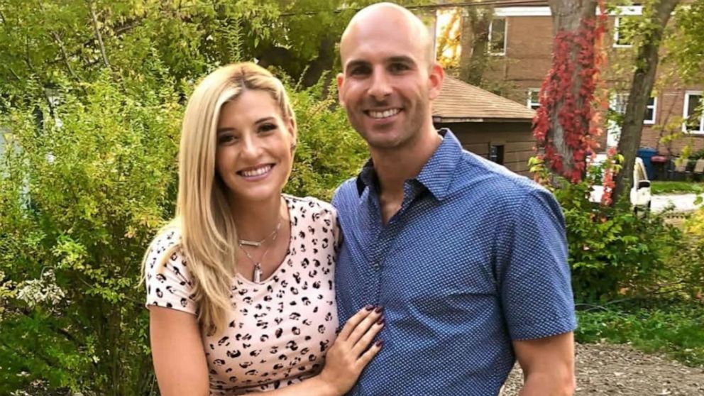 How are the Altobelli conjoined twins doing today? All the details