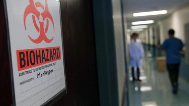 CDC issues new health alert on monkeypox