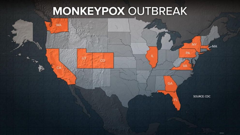 Monkeypox spreads across the US GMA