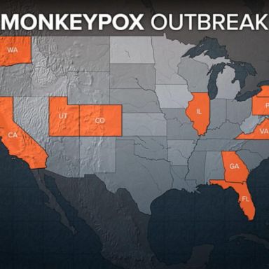 VIDEO: Monkeypox spreads across the US