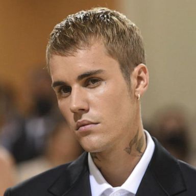 VIDEO: Justin Bieber reveals face paralysis diagnosis