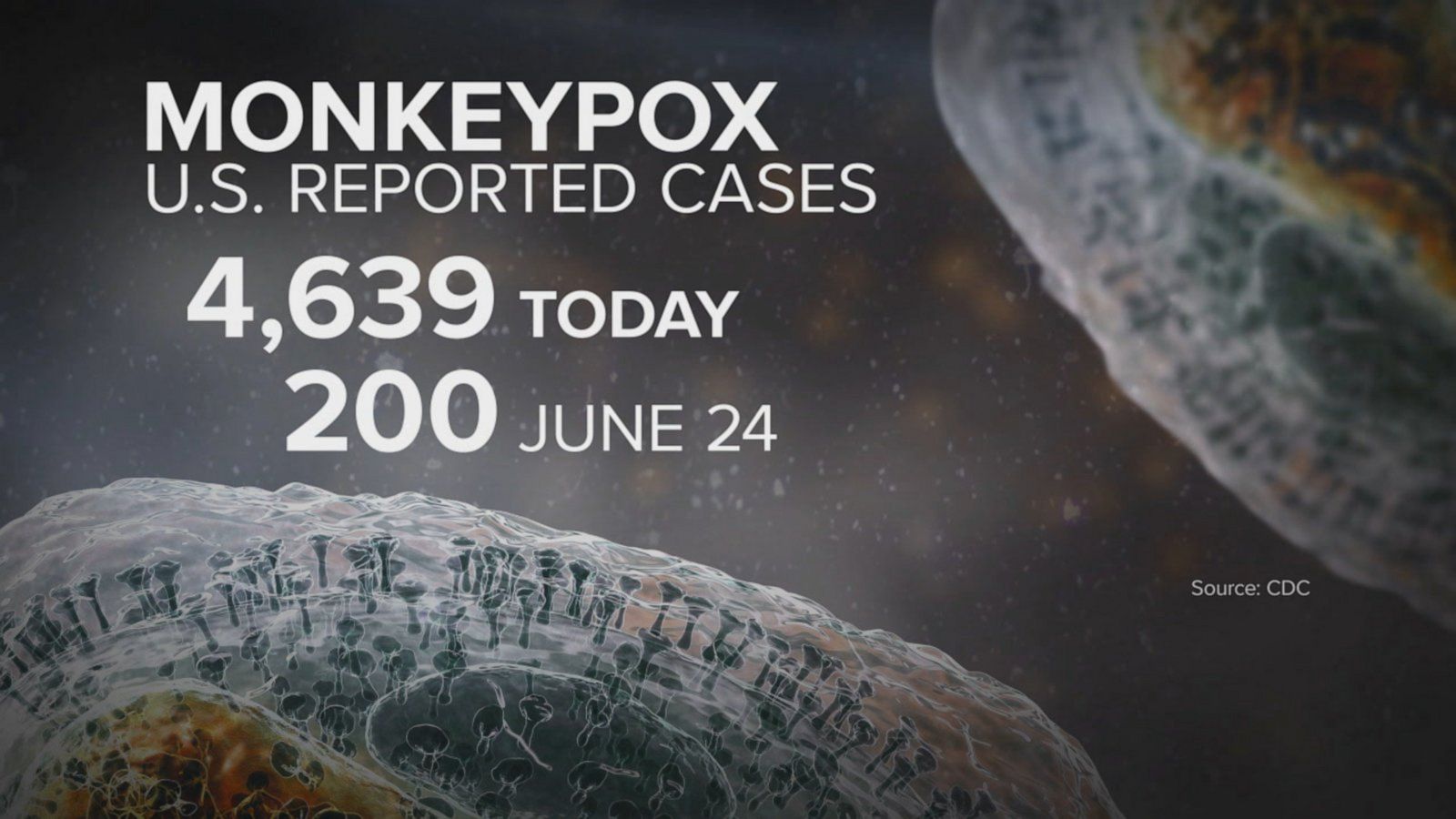 CDC reports a jump in monkeypox cases in the US Good Morning America