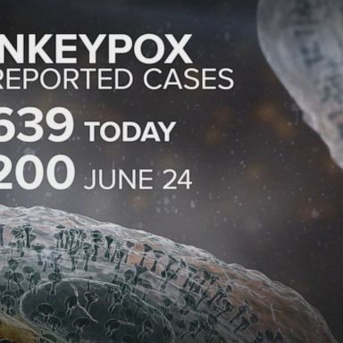 VIDEO: CDC reports a jump in monkeypox cases in the US