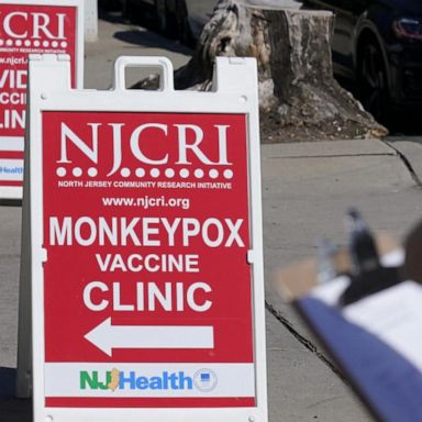 VIDEO: New York state records 1st case of juvenile monkeypox