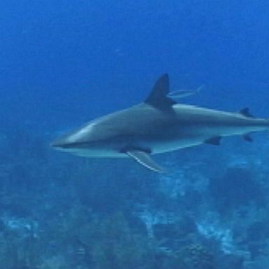 VIDEO: US tourist loses leg to shark in Caribbean