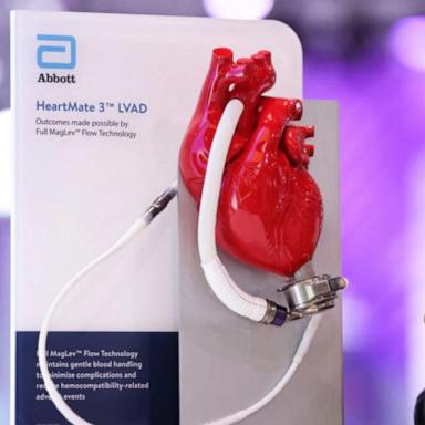 VIDEO: Heart pumps linked to deaths, injuries being recalled by FDA