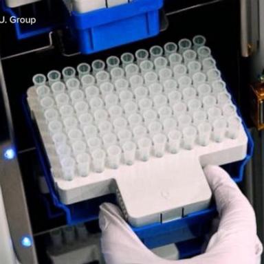 VIDEO: FDA clears 1st blood test to help diagnose Alzheimer's disease