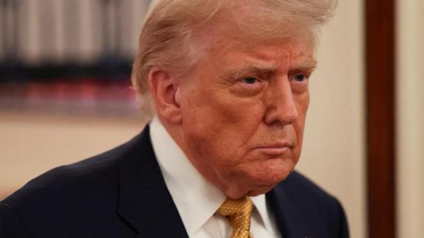 Trump diagnosed with chronic venous insufficiency, White House says