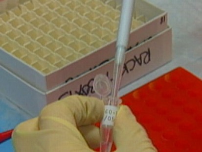 VIDEO: Detecting Alzheimers Disease