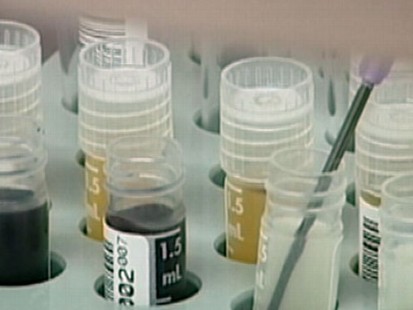 VIDEO: Congress takes action on storing umbilical cords to cure disease later in life.