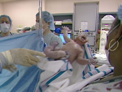 VIDEO: Cesarean deliveries are at an all time high; what does that mean for mothers?