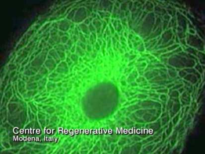 VIDEO: Stem cells from ones own eye can bring new sight to those blinded by burns.