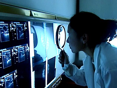VIDEO: Are Cancer Patients Being Over Diagnosed?
