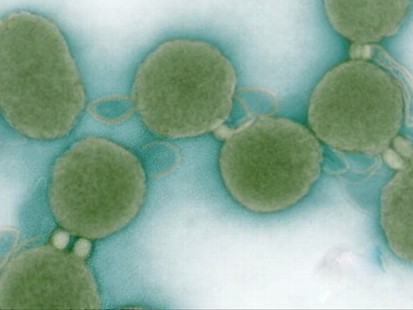 VIDEO: An organism controlled by completely manmade DNA can grow and reproduce.