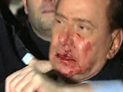 VIDEO: Did Silvio Berlusconi Deserve to Be Attacked?